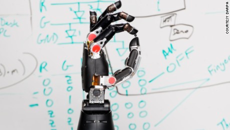 Read more about the article Prosthetic hand now able to “tell” brain what it is touching